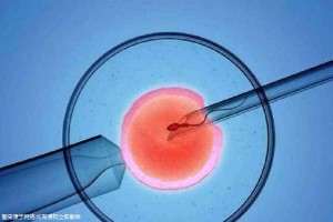 借卵代孕哪里做的最好